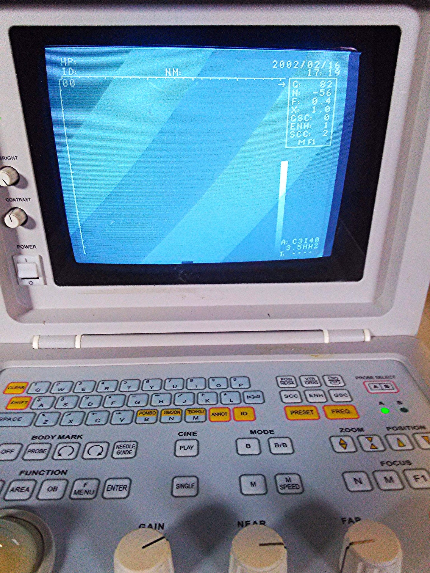 SIUI CTS-485 PORTABLE ULTRASOUND ULTRASONIC DIAGNOSTIC INSTRUMET 3.5 PROBE C3I40