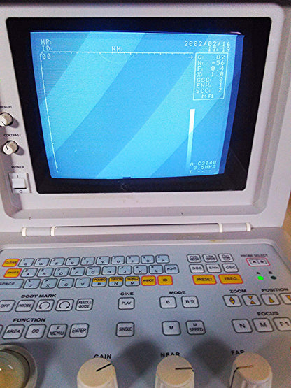 SIUI CTS-485 PORTABLE ULTRASOUND ULTRASONIC DIAGNOSTIC INSTRUMET 3.5 PROBE C3I40