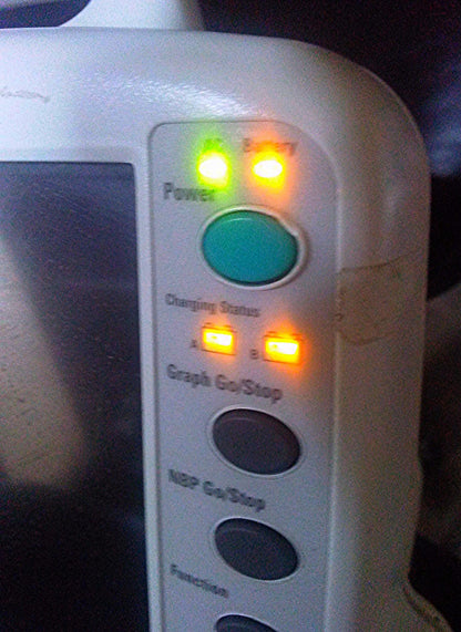 GE DASH 3000 Color Monitor ECG SPO2 Temperature CO NIBP