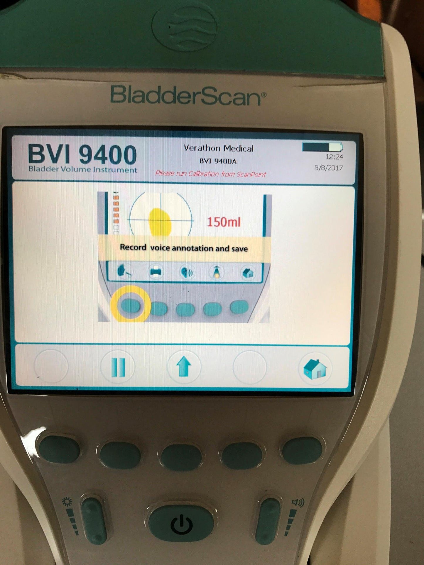 VERATHON BVI9400 BLADDER VOLUME SCAN 3D ULTRASOUND TRANSDUCER BATTERY WATCHVIDEO