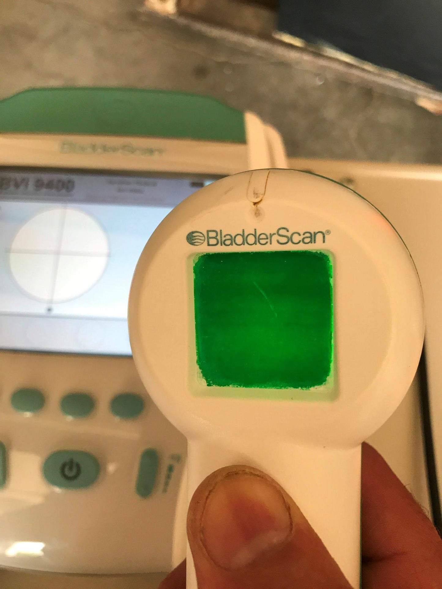 VERATHON BVI9400 BLADDER VOLUME SCAN 3D ULTRASOUND TRANSDUCER BATTERY WATCHVIDEO