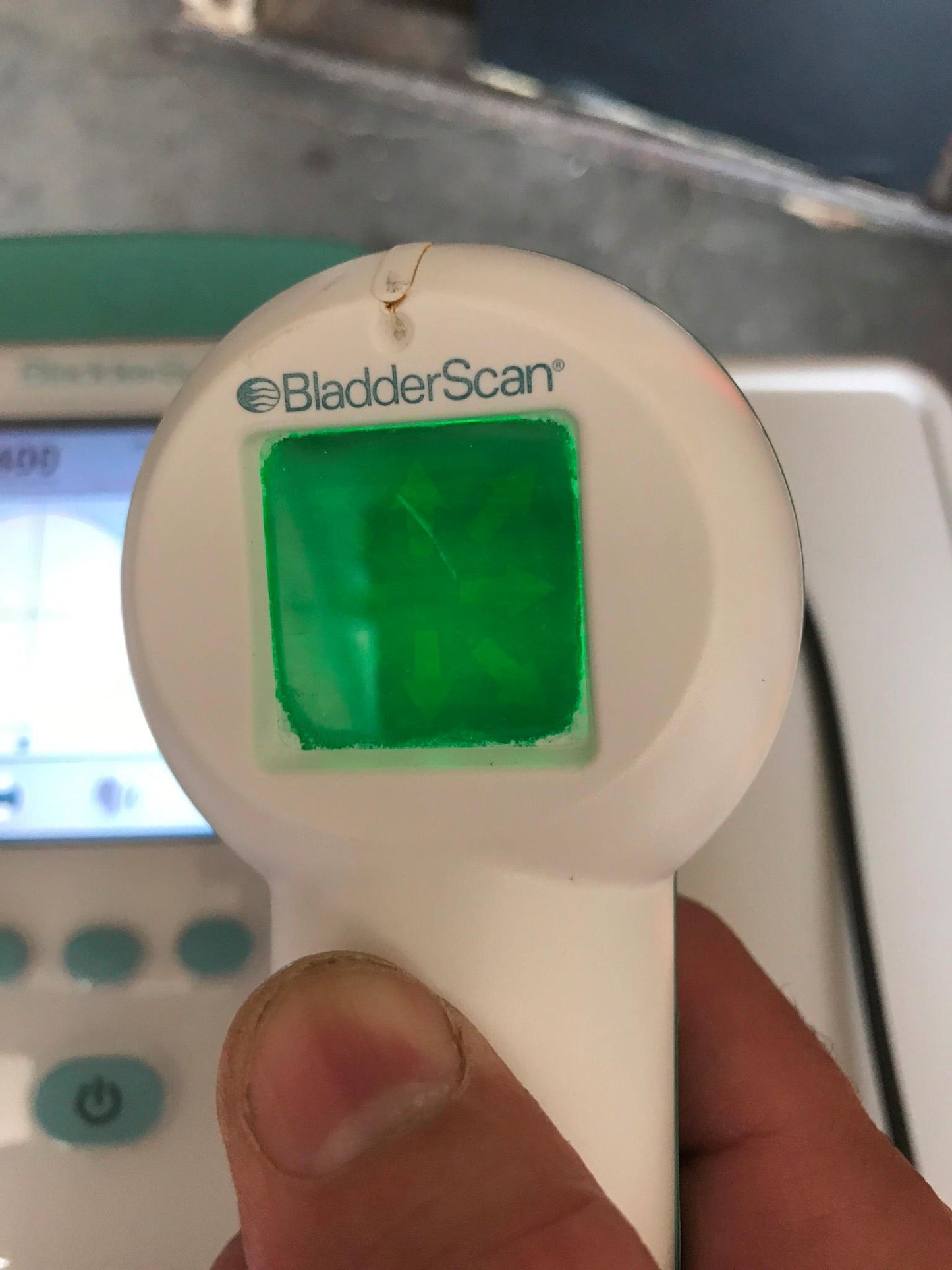 VERATHON BVI9400 BLADDER VOLUME SCAN 3D ULTRASOUND TRANSDUCER BATTERY WATCHVIDEO