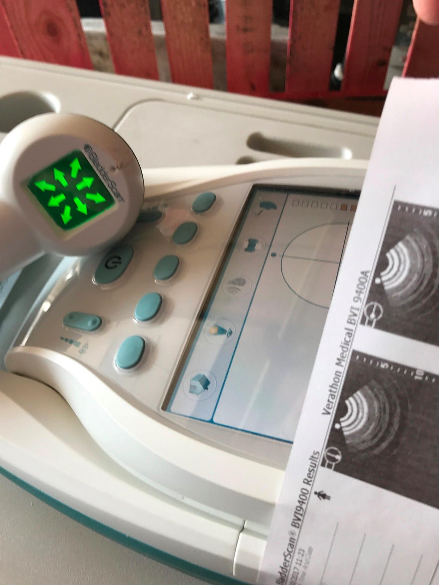 VERATHON BVI9400 BLADDER VOLUME SCAN 3D ULTRASOUND TRANSDUCER BATTERY WATCHVIDEO