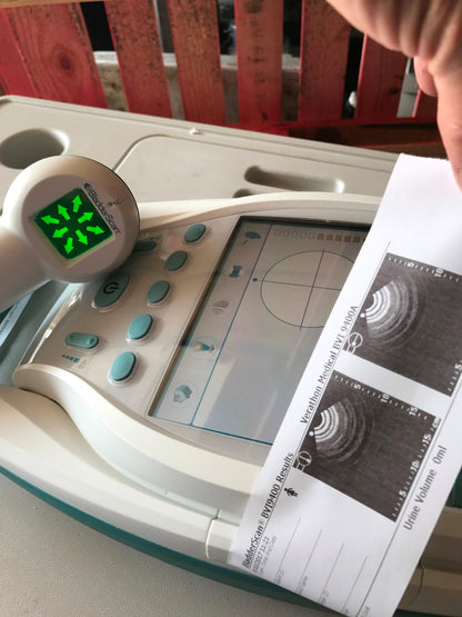 VERATHON BVI9400 BLADDER VOLUME SCAN 3D ULTRASOUND TRANSDUCER BATTERY WATCHVIDEO