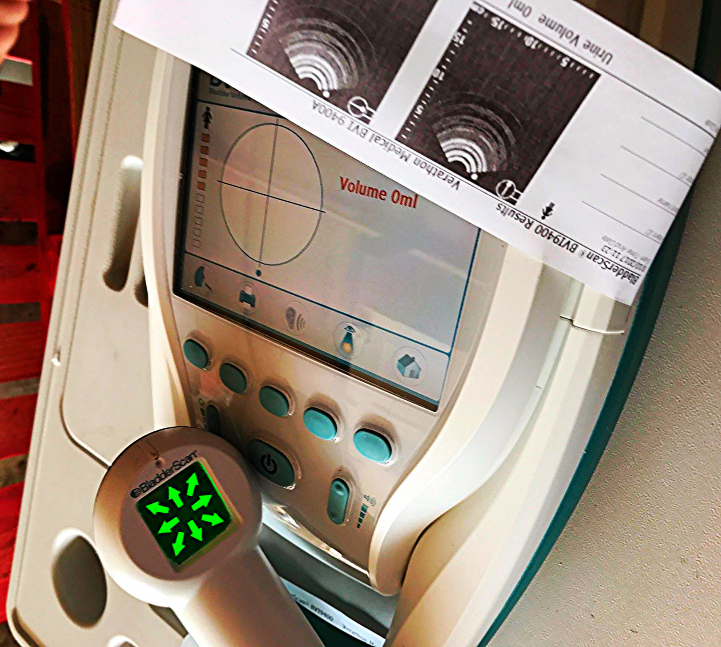 VERATHON BVI9400 BLADDER VOLUME SCAN 3D ULTRASOUND TRANSDUCER BATTERY WATCHVIDEO