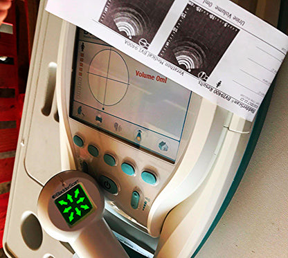 VERATHON BVI9400 BLADDER VOLUME SCAN 3D ULTRASOUND TRANSDUCER BATTERY WATCHVIDEO