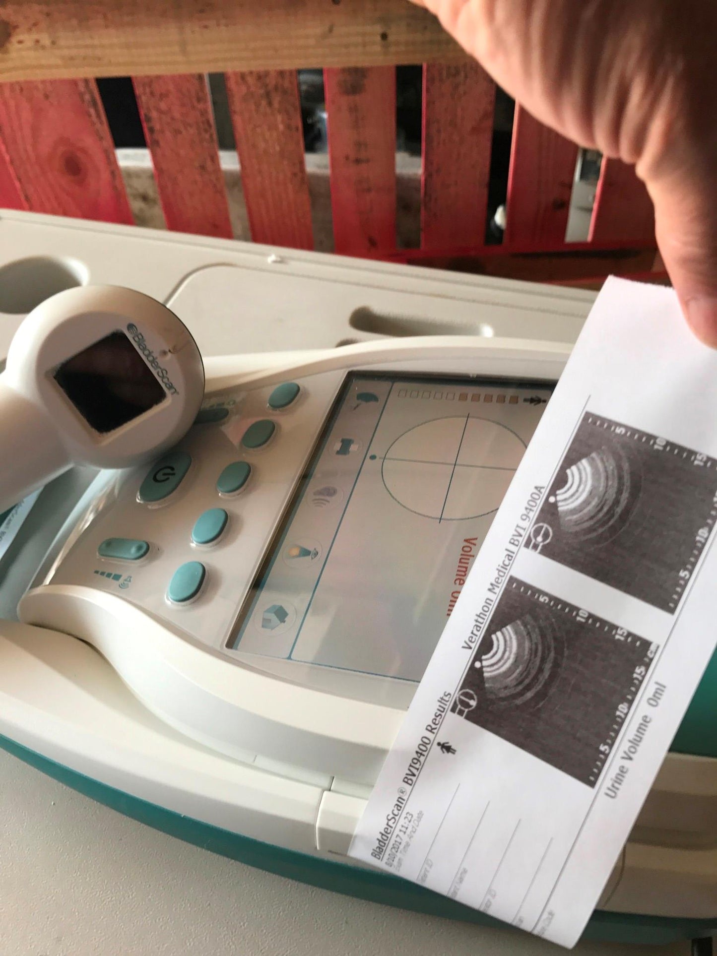 VERATHON BVI9400 BLADDER VOLUME SCAN 3D ULTRASOUND TRANSDUCER BATTERY WATCHVIDEO