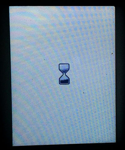 ALERE AFINION AS100 POC BLOOD PLASMA URINE ANALYZER WATCH VIDEO FREE SHIP