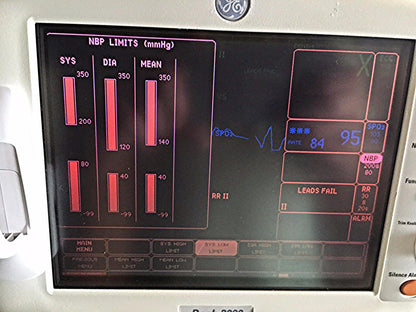 GE DASH 3000 Vital Signs Monitor & STAND LEADS CUFF OXIMETER PRINTER WATCHVIDEO