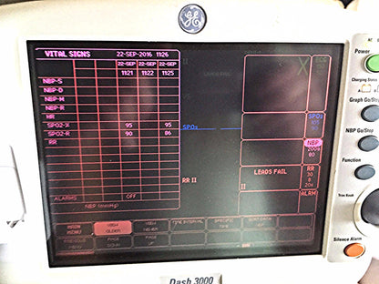 GE DASH 3000 Vital Signs Monitor & STAND LEADS CUFF OXIMETER PRINTER WATCHVIDEO