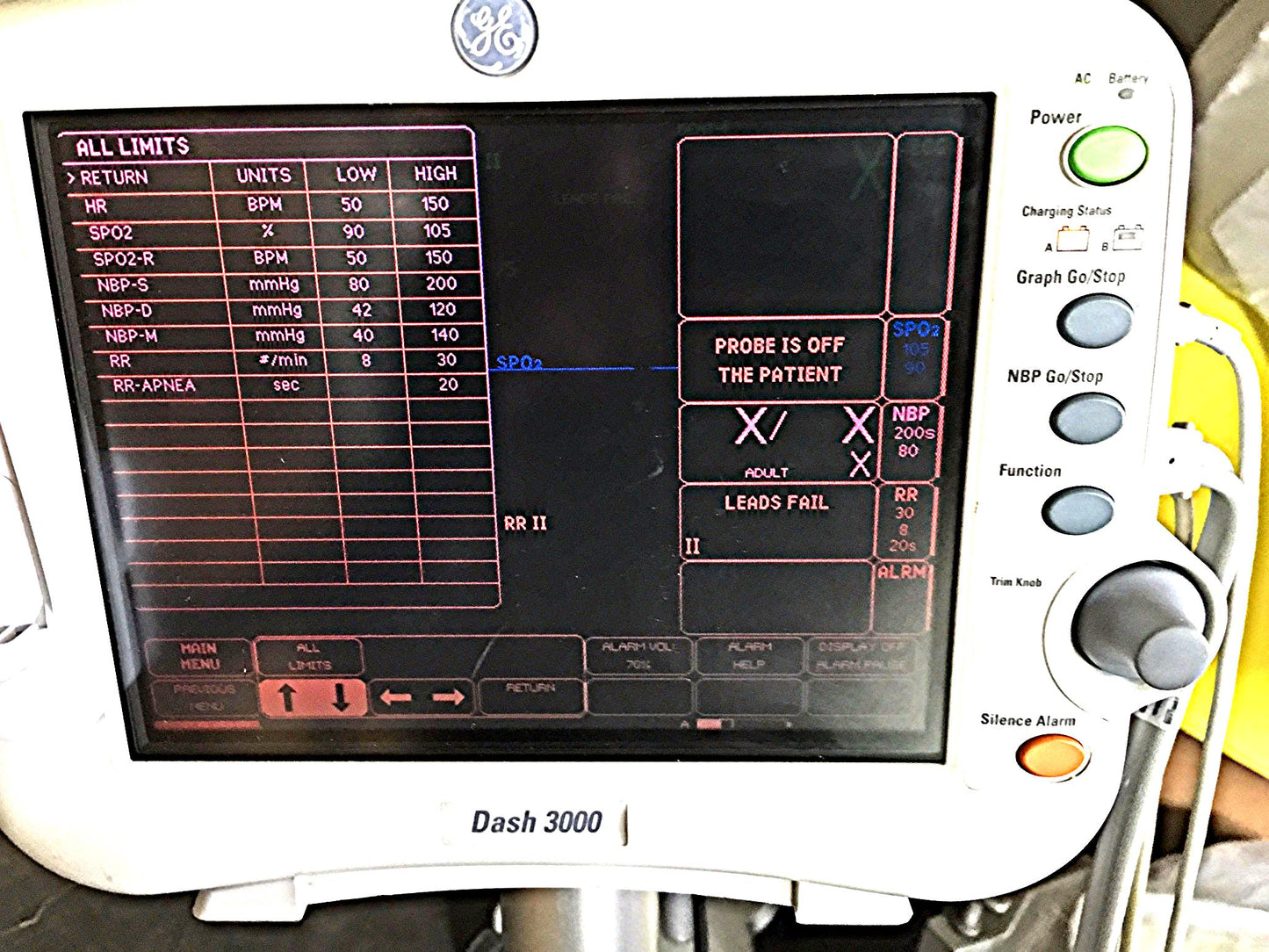 GE DASH 3000 Vital Signs Monitor & STAND LEADS CUFF OXIMETER PRINTER WATCHVIDEO