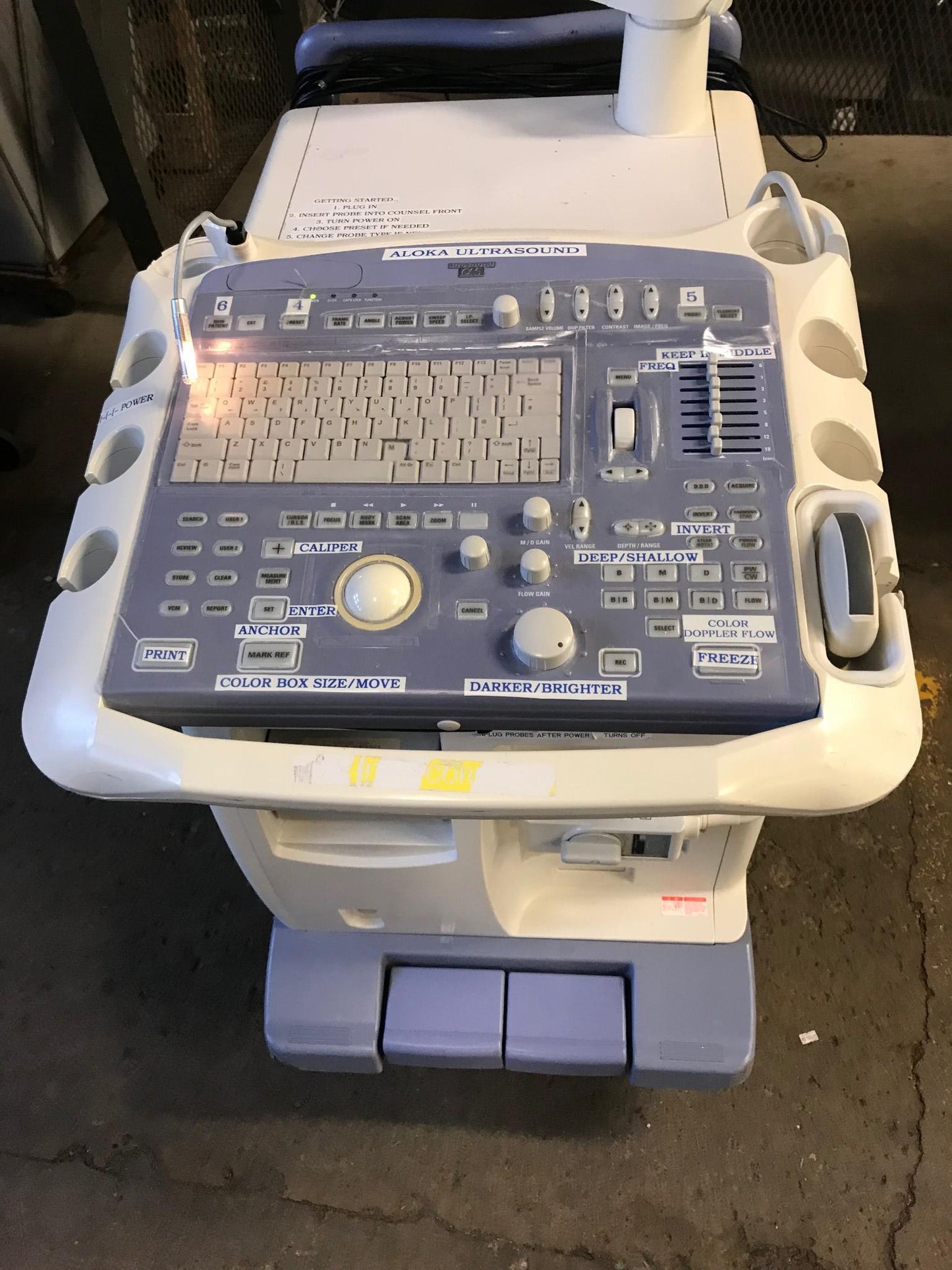 ALOKA PROSOUND SSD ALPHA 5 OB / GYN ULTRASOUND w/ UST-9126 TRANSDUCER FREE SHIP