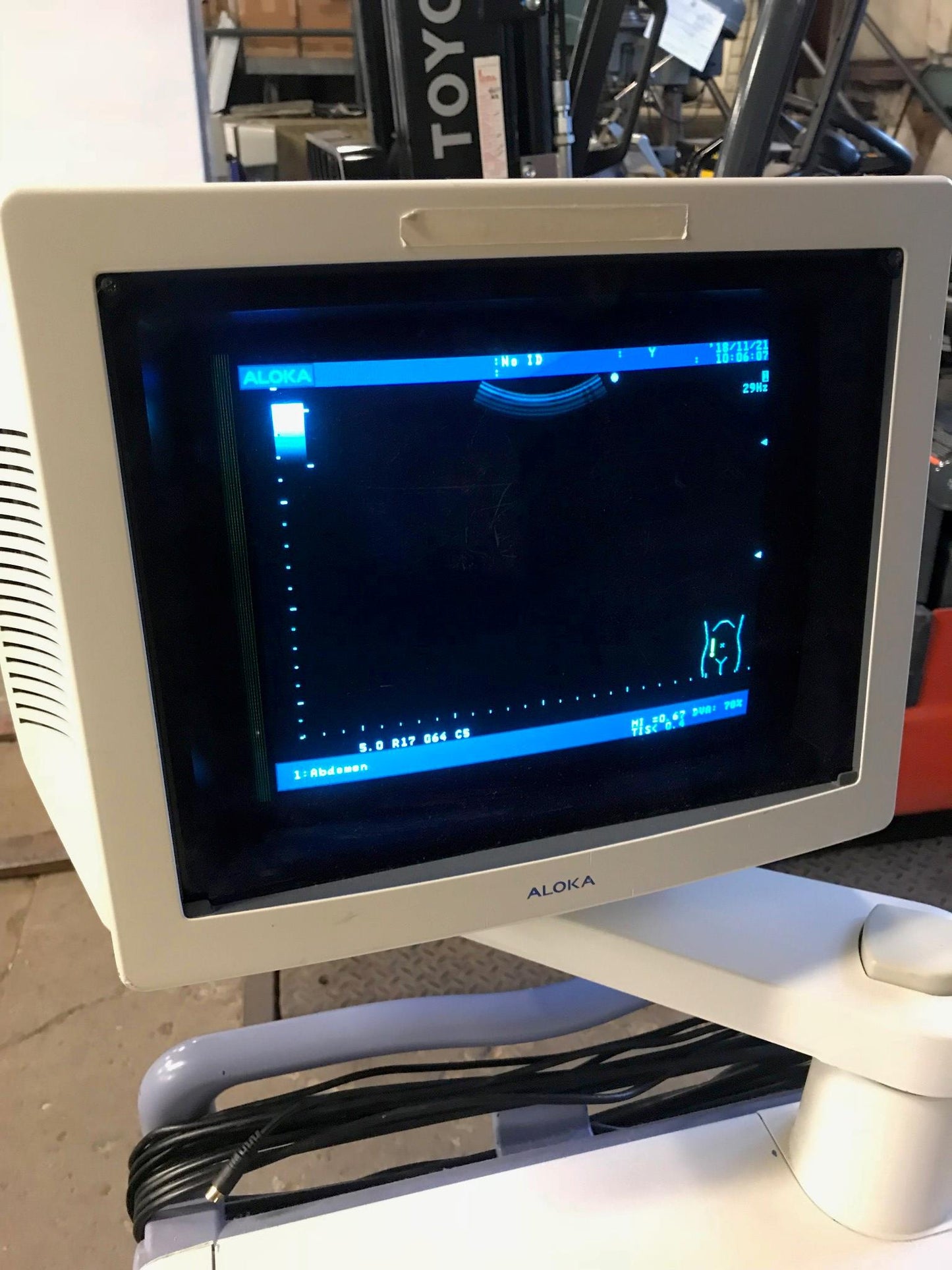 ALOKA PROSOUND SSD ALPHA 5 OB / GYN ULTRASOUND w/ UST-9126 TRANSDUCER FREE SHIP