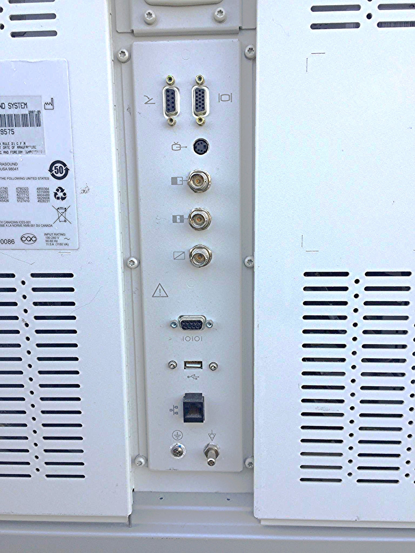 PHILIPS EnVisor C1 M2540A ULTRASOUND SYSTEM C5-2 PROBE & SONY PRINTER / WARRANTY