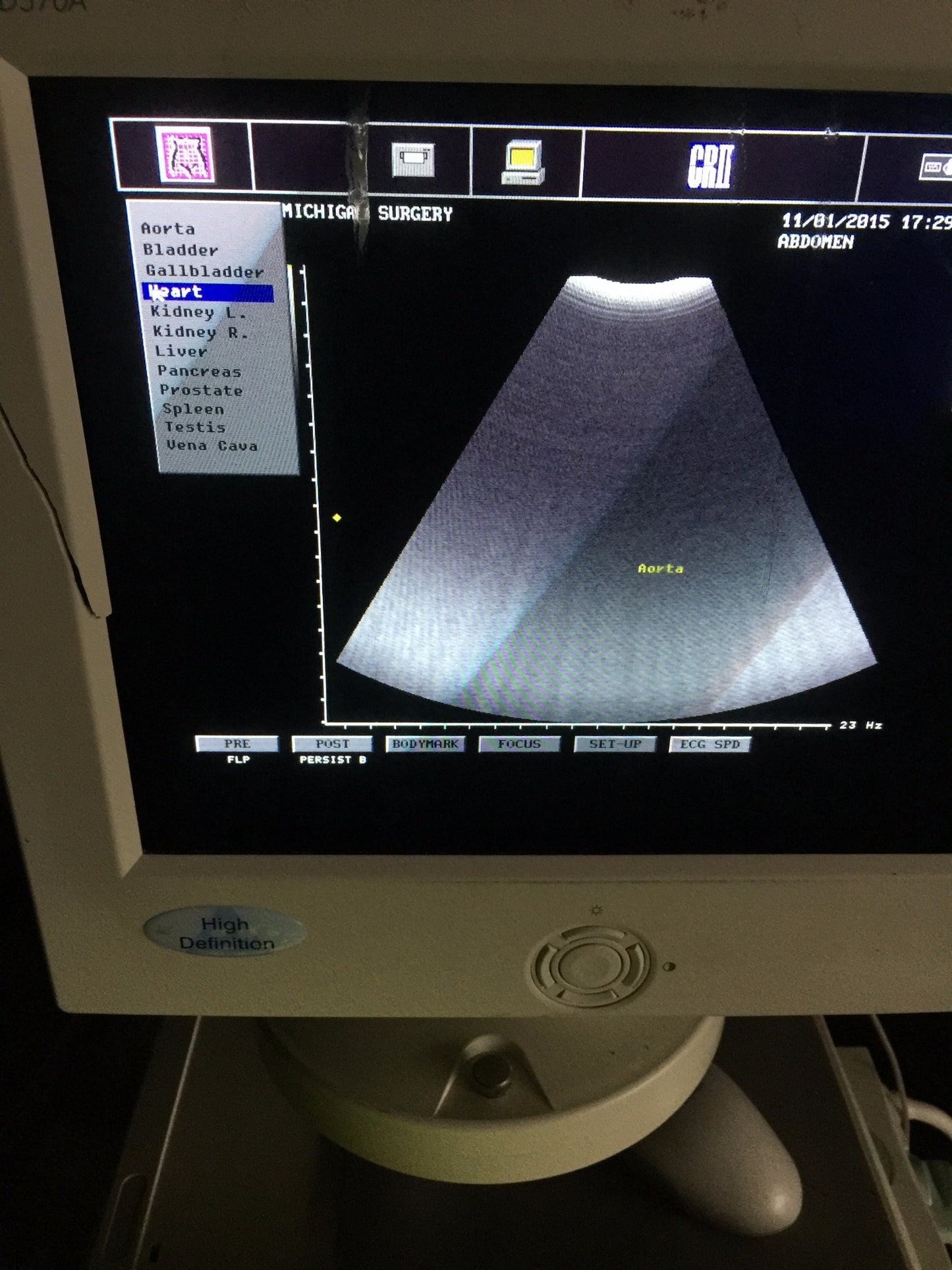 PICUS CRII ESAOTE PIE MED 410670 ULTRASOUND C5-2 R40 & LA523 PROBE SONY UP-895MD
