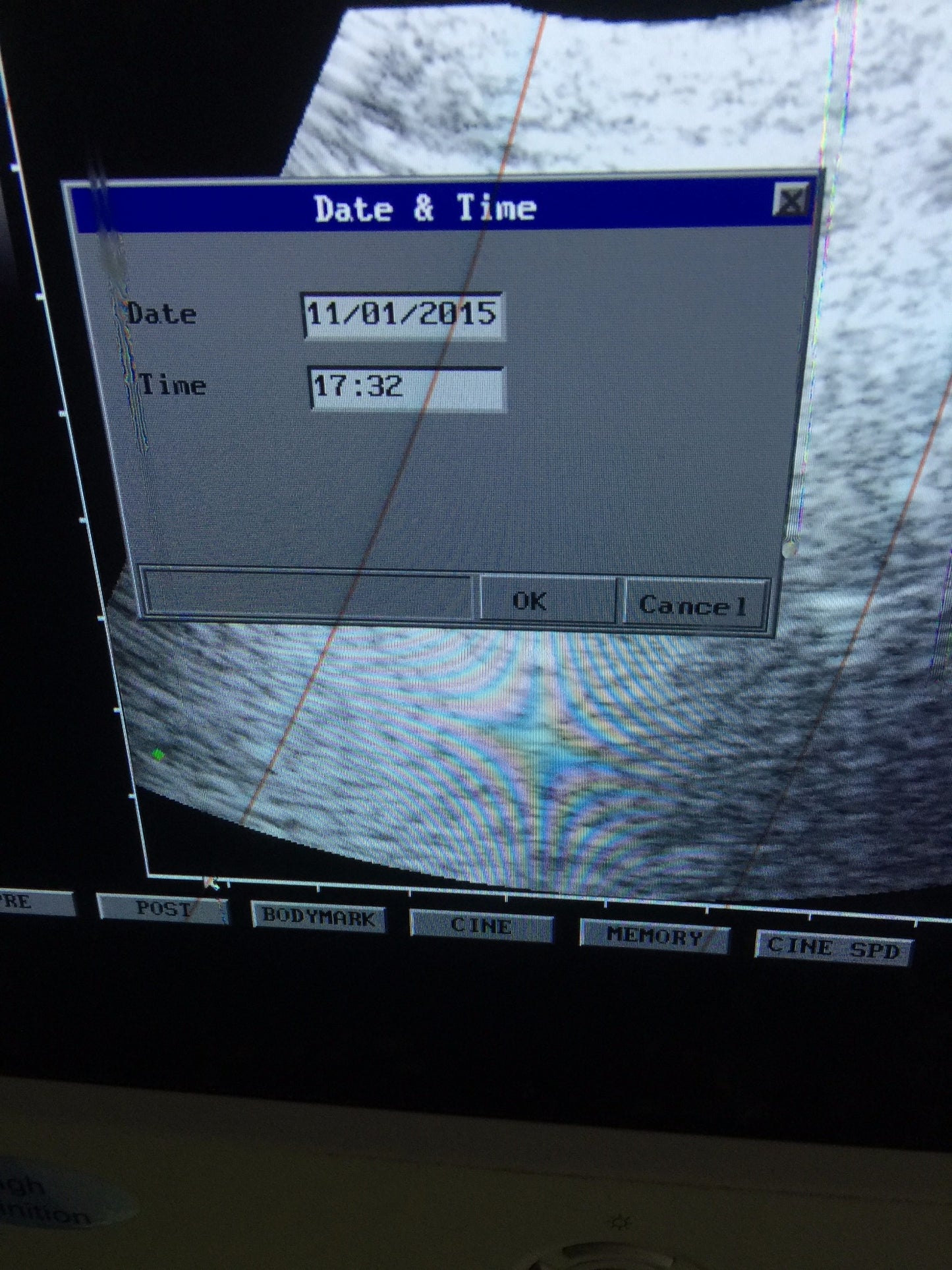 PICUS CRII ESAOTE PIE MED 410670 ULTRASOUND C5-2 R40 & LA523 PROBE SONY UP-895MD