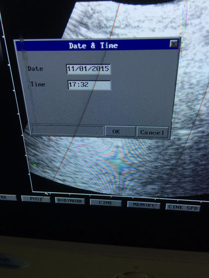 PICUS CRII ESAOTE PIE MED 410670 ULTRASOUND C5-2 R40 & LA523 PROBE SONY UP-895MD