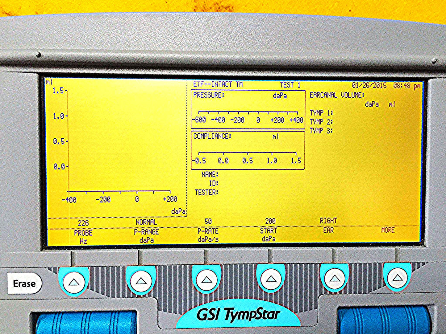 GSI TYMPSTAR MIDDLE EAR ANALYZER TYMPANOMETER