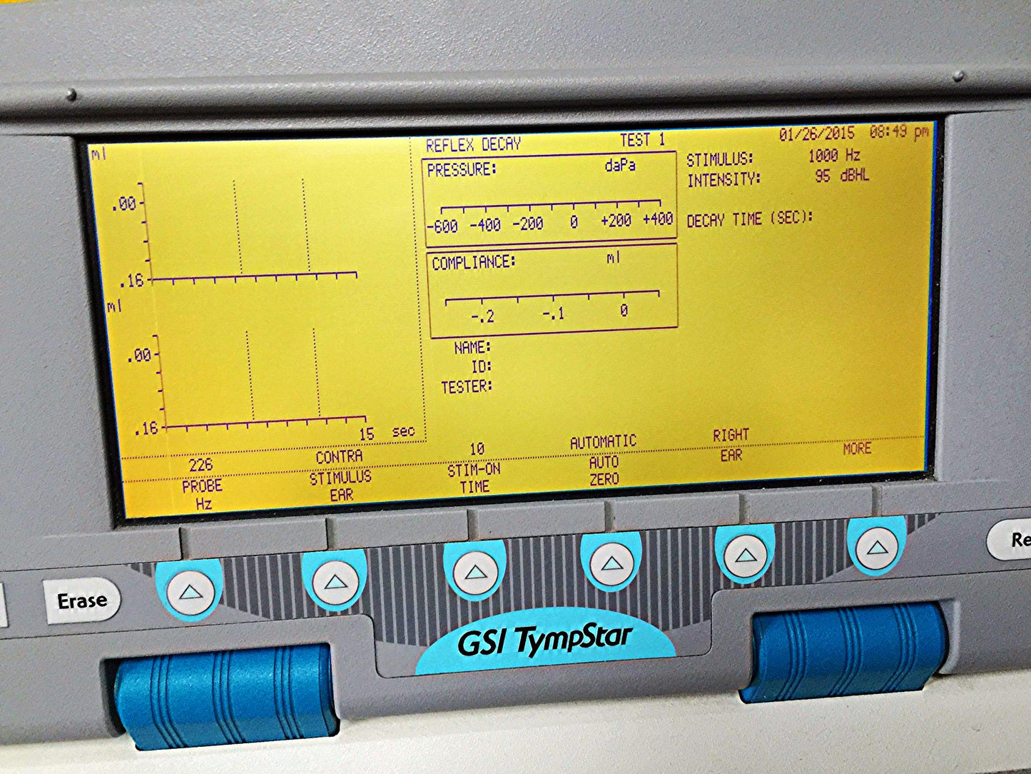 GSI TYMPSTAR MIDDLE EAR ANALYZER TYMPANOMETER