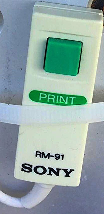 iLOOK SONOSITE L25 PERSONAL IMAGING TOOL ULTRASOUND STAND TRANSDUCER WATCH VIDEO