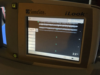 iLOOK SONOSITE L25 PERSONAL IMAGING TOOL ULTRASOUND STAND TRANSDUCER WATCH VIDEO