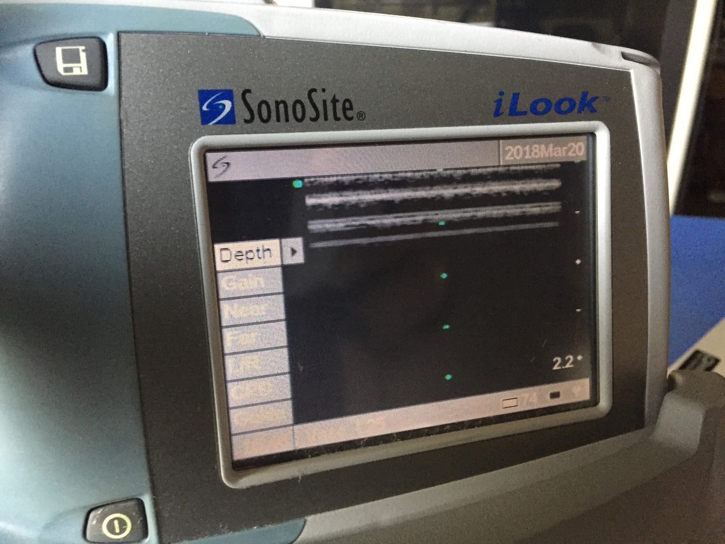 iLOOK SONOSITE L25 PERSONAL IMAGING TOOL ULTRASOUND STAND TRANSDUCER WATCH VIDEO