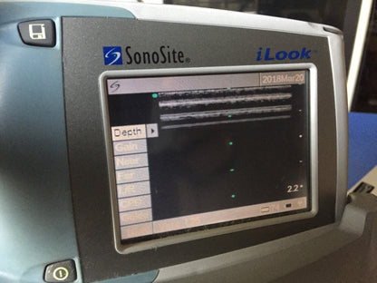 iLOOK SONOSITE L25 PERSONAL IMAGING TOOL ULTRASOUND STAND TRANSDUCER WATCH VIDEO