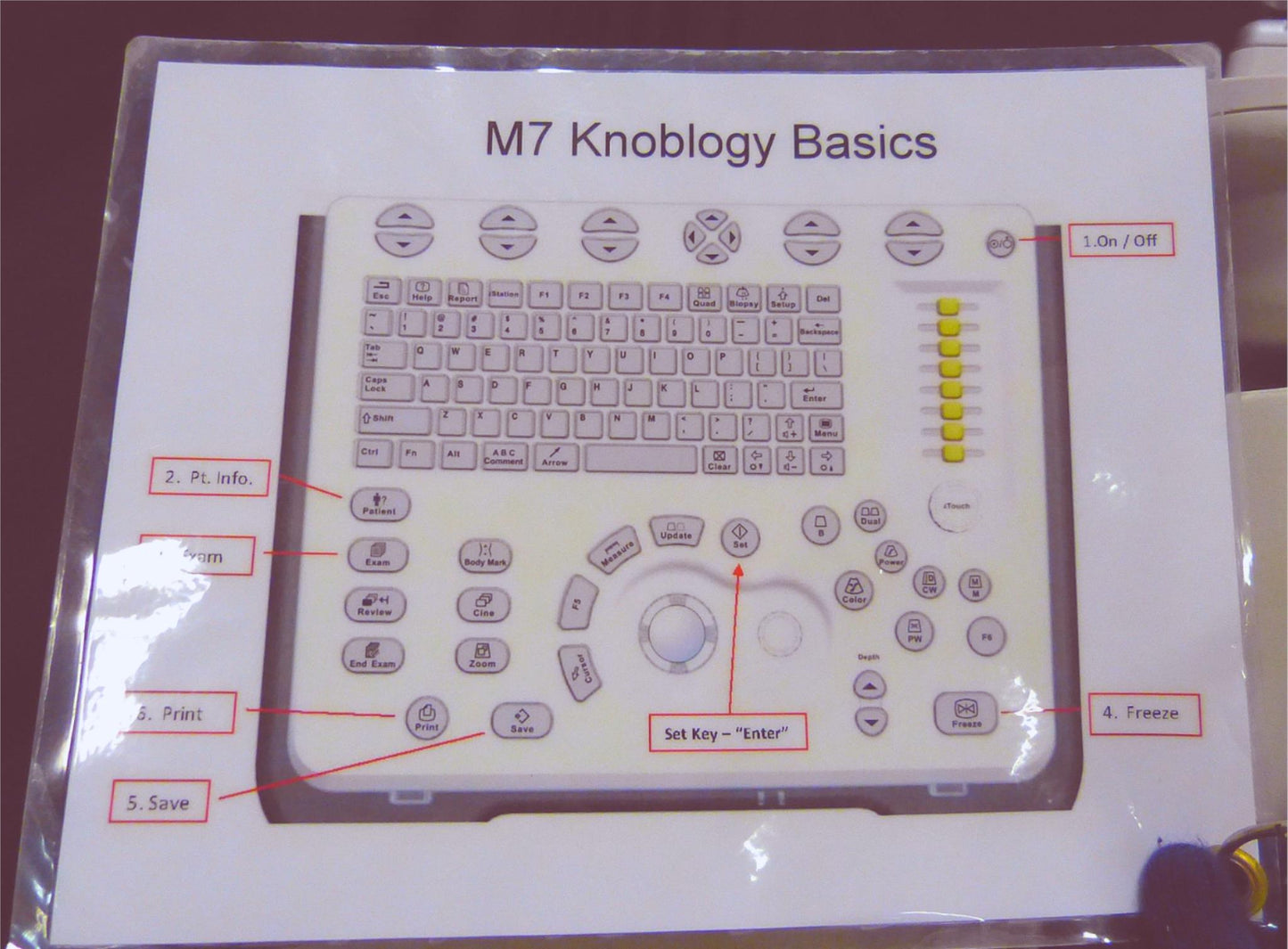 WARRANTY MINDRAY M7 ULTRASOUND w/ C5-2S & P4-2S TRANSDUCERs & M300 CART FREESHIP