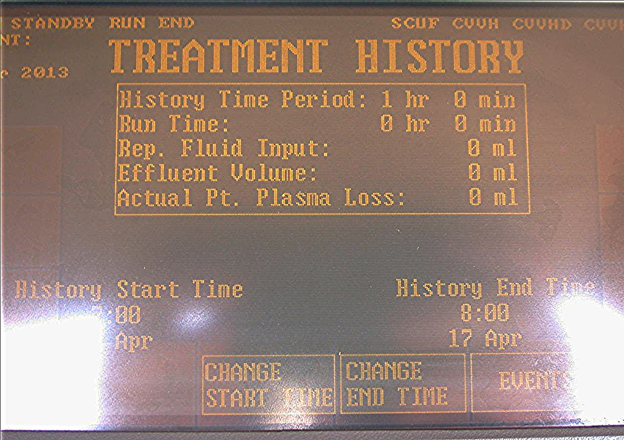 GAMBRO HEALTHCARE PRISMA CONTROL UNIT CRRT-TPE 2000 EXTRA HEMODIALYSIS MACHINE
