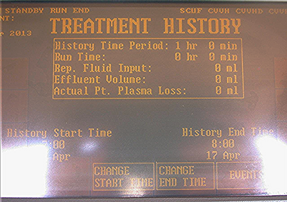 GAMBRO HEALTHCARE PRISMA CONTROL UNIT CRRT-TPE 2000 EXTRA HEMODIALYSIS MACHINE