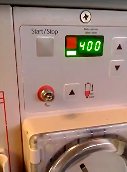 FRESENIUS 2008K DIALYSIS HEMODIALYSIS Kidney WATCH VIDEO GUARANTED 100% FREESHIP