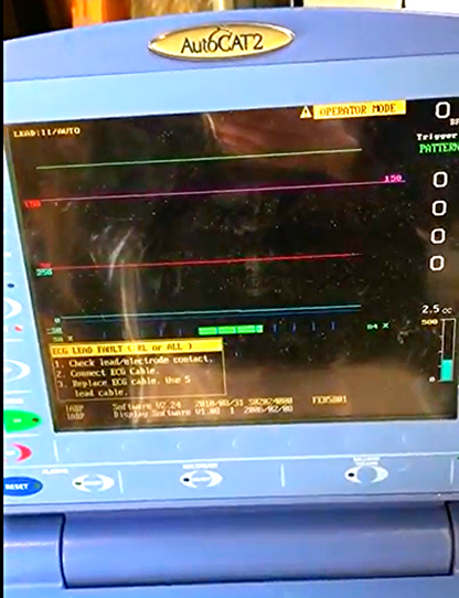 INTRA AORTIC BALLOON PUMP ARROW 2 WAVE IABP CARDIAC "BUY 1 GET 2" WATCH VIDEO