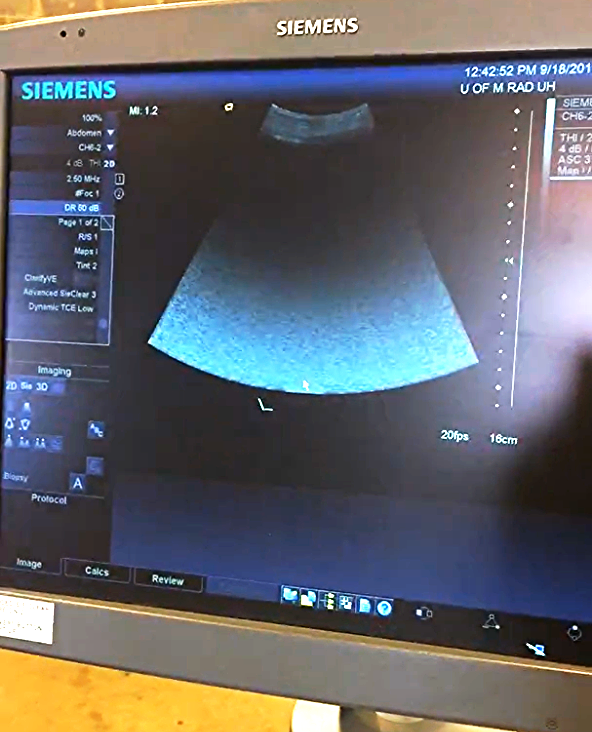 SIEMENS AUCSON ANTARES PREMIUM EDITION ULTRASOUND & VFX 13.5 CH6-2 4-1 PROBE