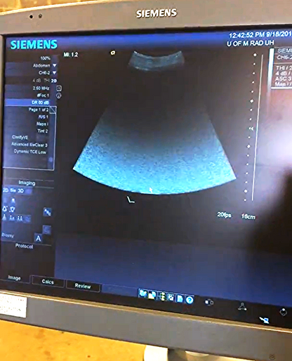 SIEMENS AUCSON ANTARES PREMIUM EDITION ULTRASOUND & VFX 13.5 CH6-2 4-1 PROBE
