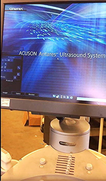SIEMENS AUCSON ANTARES PREMIUM EDITION ULTRASOUND & VFX 13.5 CH6-2 4-1 PROBE