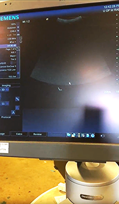 SIEMENS AUCSON ANTARES PREMIUM EDITION ULTRASOUND & VFX 13.5 CH6-2 4-1 PROBE