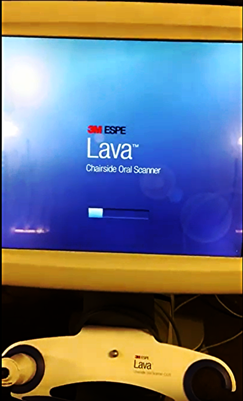 3M ESPE Lava COS Chairside Oral Scanner Digital Intraoral 3-D Dental Imaging WOW