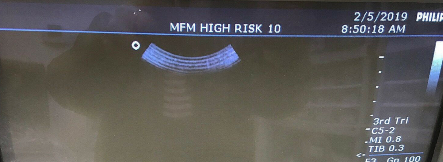 PHILIPS ENVISOR ULTRASOUND C5-2 PROBE & MANUAL FREE SHIP