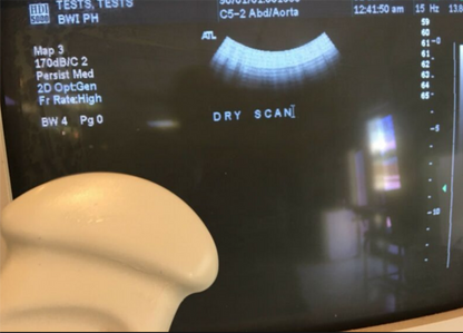 PHILIPS ENVISOR ULTRASOUND C5-2 PROBE & MANUAL FREE SHIP