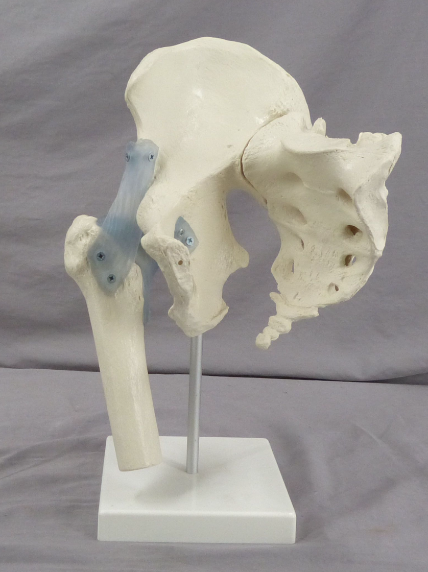 Pelvis, Right Side Teaching Model-Single Part