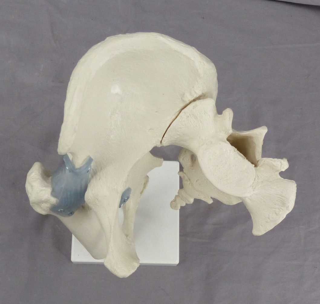 Pelvis, Right Side Teaching Model-Single Part