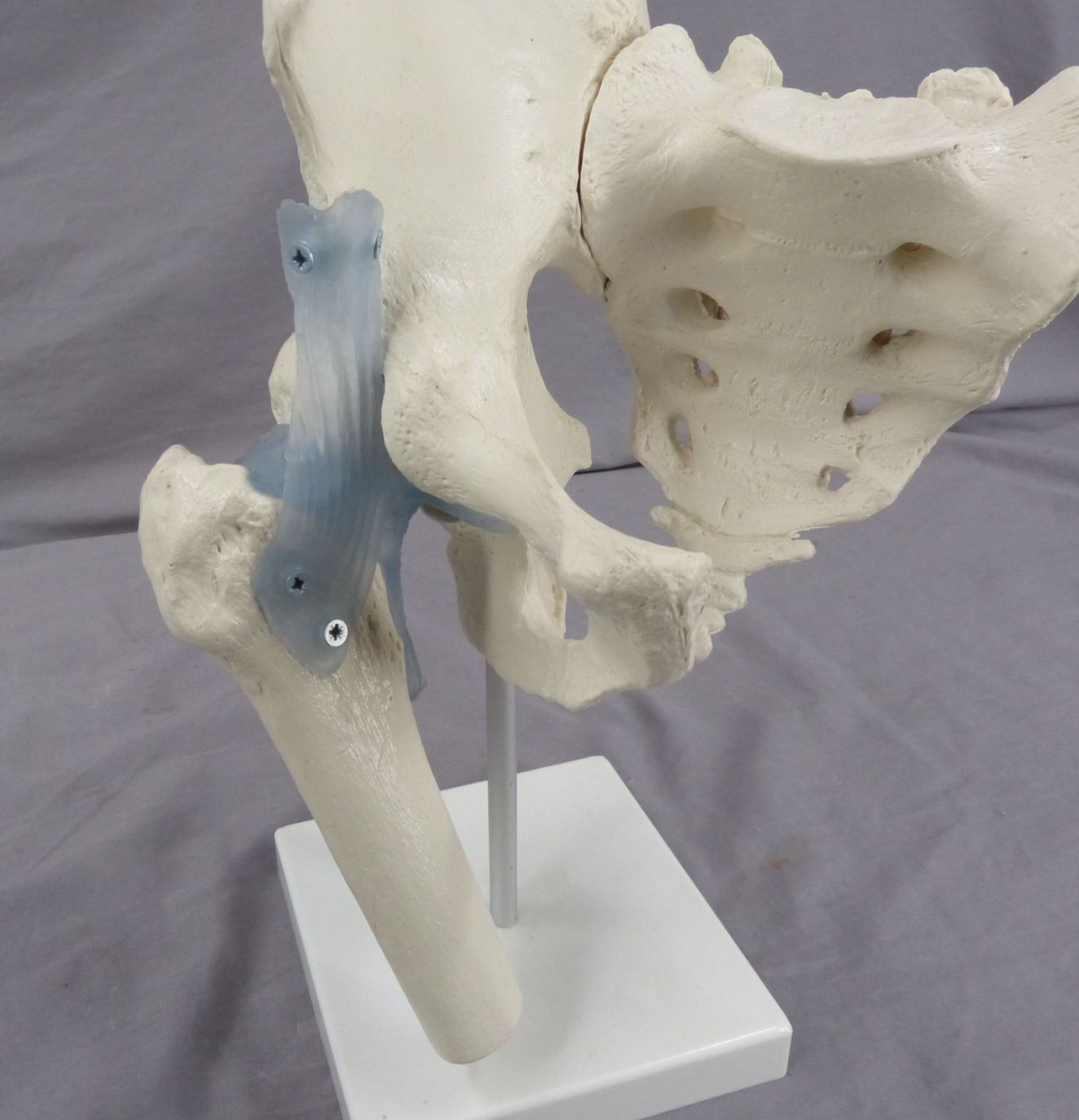 Pelvis, Right Side Teaching Model-Single Part