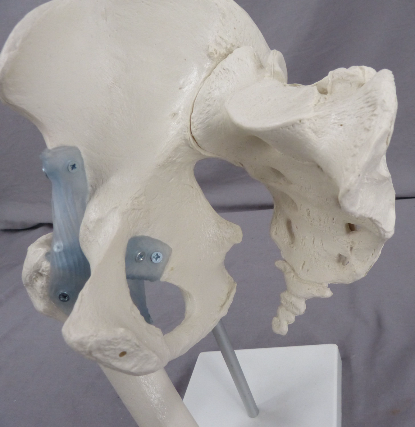 Pelvis, Right Side Teaching Model-Single Part
