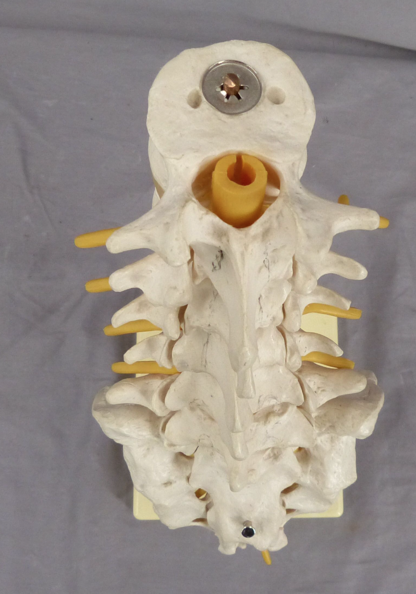 3B Lumbar Spine Teaching Model-Single Part