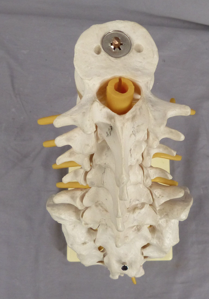 3B Lumbar Spine Teaching Model-Single Part