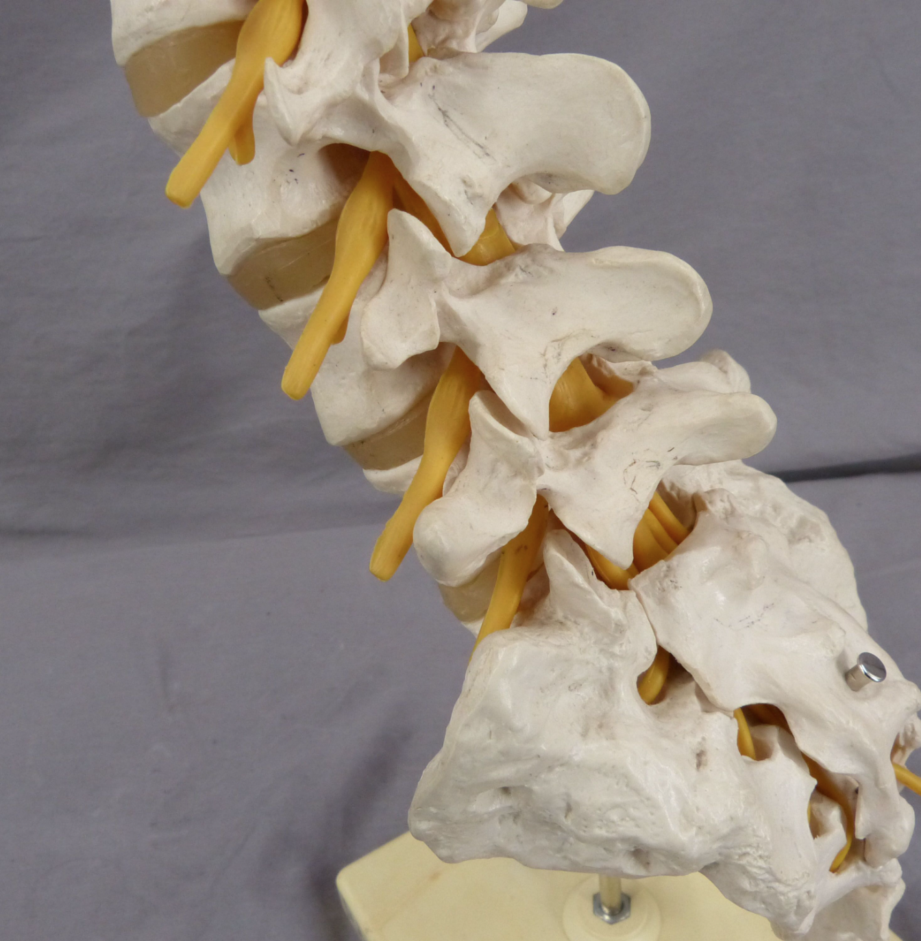 3B Lumbar Spine Teaching Model-Single Part