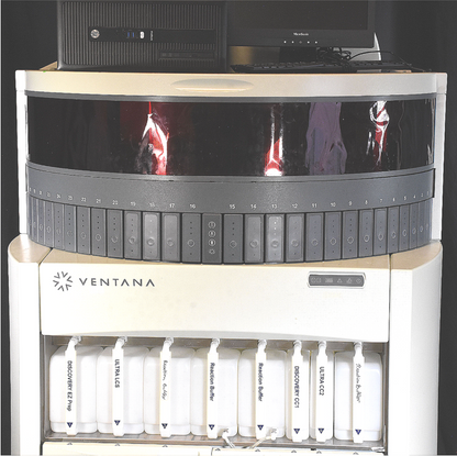 ROCHE VENTANA BENCHMARK ULTRA TISSUE DIAGNOSTIC KLF STAINER WATCH-VIDEO FREESHIP