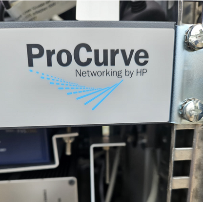 PHILIPS PROFOUND MEDICAL SONALLEVE MR HIFU V2 INGENIA 3T UTER ULTRASOUND SCANNER