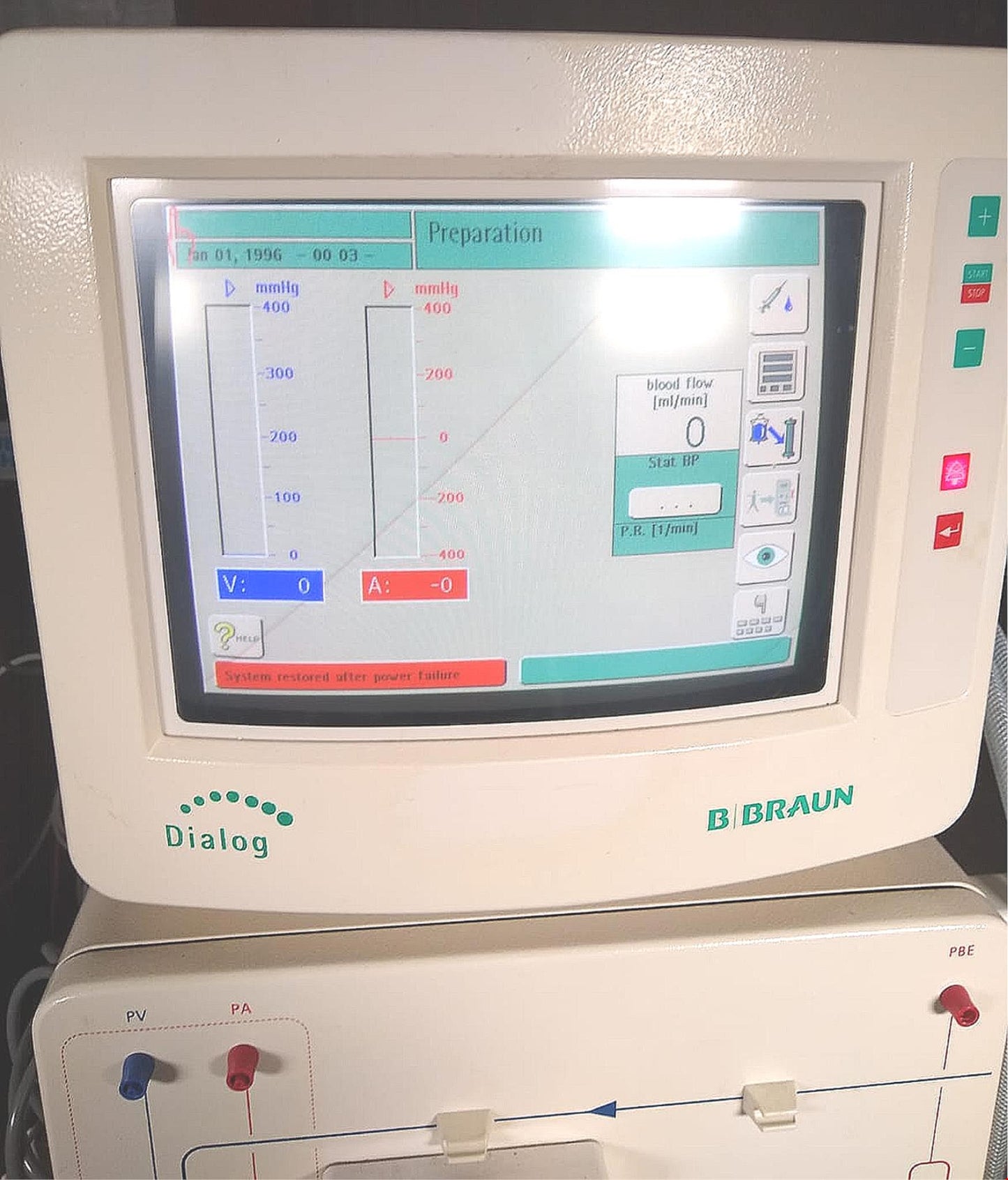 B BRAUN DIALOG+® CRRT HEMODIALYSIS MACHINE *SeemsToWorkFine* WATCHVIDEO FREESHIP